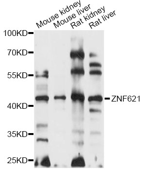 Western blot - ZNF621 Polyclonal Antibody 