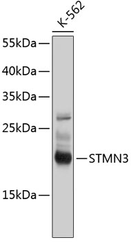 Western blot - STMN3 Polyclonal Antibody 