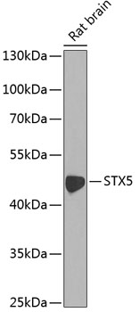 Western blot - STX5 Polyclonal Antibody 