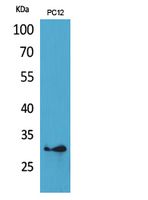 Fig1:; Western Blot analysis of PC12 cells using HLA-DQB1/2 Polyclonal Antibody.. Secondary antibody（catalog#：HA1001) was diluted at 1:20000