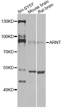 Western blot - ARNT Polyclonal Antibody 