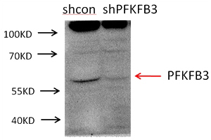 A549 cells were subjected to SDS PAGE followed by western blot with Catalog No:113770(PFKFB3 antibody) at dilution of 1:1000. (Data provided by Angran Biotech (www.miRNAlab.com)).