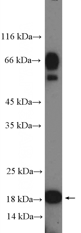 HeLa cells were subjected to SDS PAGE followed by western blot with Catalog No:113535(CDKN2B Antibody) at dilution of 1:600
