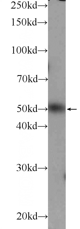 mouse testis tissue were subjected to SDS PAGE followed by western blot with Catalog No:116912(ZBTB25 Antibody) at dilution of 1:600