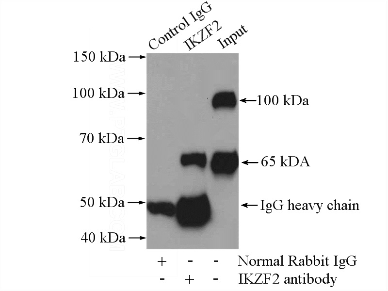 IP Result of anti-IKZF2 (IP:Catalog No:111648, 4ug; Detection:Catalog No:111648 1:300) with Jurkat cells lysate 2400ug.