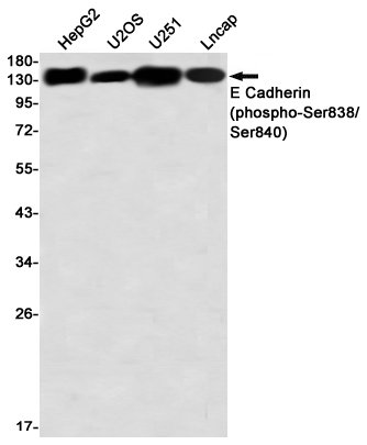 Western blot detection of E Cadherin (phospho-Ser838/Ser840) in HepG2,U2OS,U251,Lncap using E Cadherin (phospho-Ser838/Ser840) Rabbit mAb(1:1000 diluted)