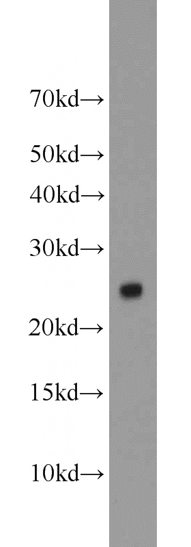 HEK-293 cells were subjected to SDS PAGE followed by western blot with Catalog No:115995(TFAM antibody) at dilution of 1:1000