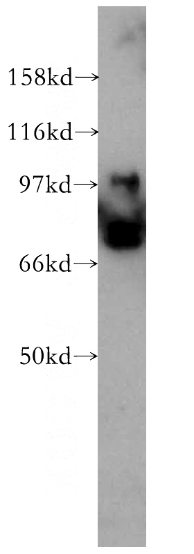mouse testis tissue were subjected to SDS PAGE followed by western blot with Catalog No:110752(FXR1 antibody) at dilution of 1:300