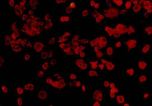 Fig2: ICC staining FGFR2 in MCF-7 cells (red). Cells were fixed in paraformaldehyde, permeabilised with 0.25% Triton X100/PBS.
