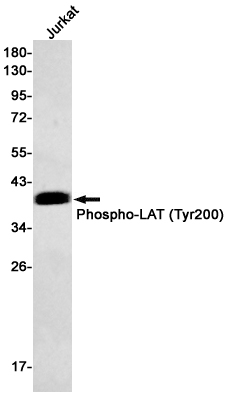 Western blot detection of Phospho-LAT (Tyr200) in Jurkat cell lysates using Phospho-LAT (Tyr200) Rabbit mAb(1:500 diluted).Predicted band size:28kDa.Observed band size:36-38kDa.