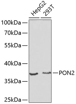 Western blot - PON2 Polyclonal Antibody 