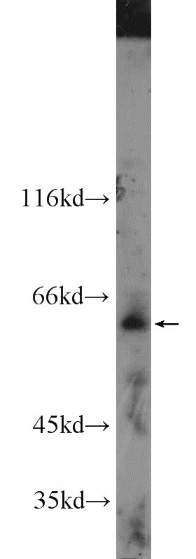 mouse lung tissue were subjected to SDS PAGE followed by western blot with Catalog No:110583(FAM20A Antibody) at dilution of 1:600