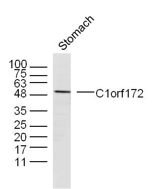 Fig2: Sample: Stomach (Mouse) Lysate at 40 ug; Primary: Anti-C1orf172 at 1/300 dilution; Secondary: IRDye800CW Goat Anti-Rabbit IgG at 1/20000 dilution; Predicted band size: 44 kD; Observed band size: 49 kD