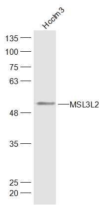 Fig1: Sample:; Hcclm3(Human) Cell Lysate at 30 ug; Primary: Anti-MSL3L2 at 1/300 dilution; Secondary: IRDye800CW Goat Anti-Rabbit IgG at 1/20000 dilution; Predicted band size: 51 kD; Observed band size: 51 kD