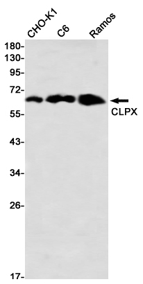 Western blot detection of CLPX in CHO-K1,C6,Ramos using CLPX Rabbit mAb(1:1000 diluted)
