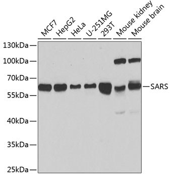 Western blot - SARS Polyclonal Antibody 