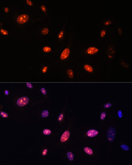 Immunofluorescence - ZNF177 Polyclonal Antibody 