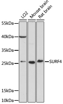 Western blot - SURF4 Polyclonal Antibody 