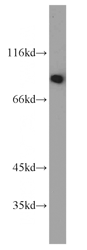 K-562 cells were subjected to SDS PAGE followed by western blot with Catalog No:116326(TRIP10 antibody) at dilution of 1:2000