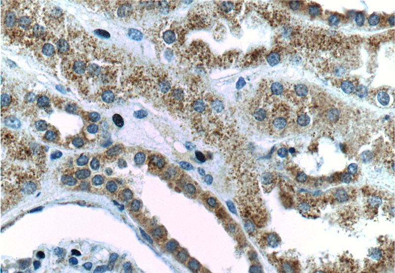 Immunohistochemistry of paraffin-embedded human kidney tissue slide using Catalog No:114300(PSEN2-Specific Antibody) at dilution of 1:200 (under 40x lens)