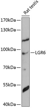 Western blot - LGR6 Polyclonal Antibody 