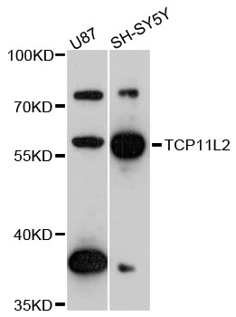 Western blot - TCP11L2 Polyclonal Antibody 