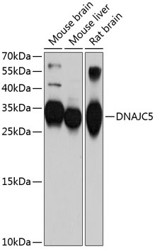 Western blot - DNAJC5 Polyclonal Antibody 
