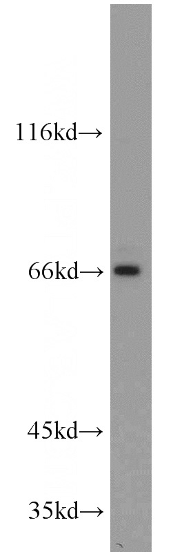 MCF7 cells were subjected to SDS PAGE followed by western blot with Catalog No:113959(PLEKHA9 antibody) at dilution of 1:500