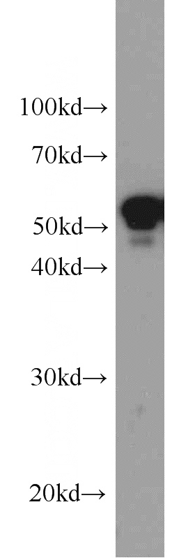 HepG2 cells were subjected to SDS PAGE followed by western blot with Catalog No:109810(KRT7 antibody) at dilution of 1:600