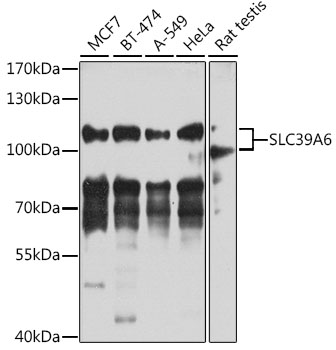 Western blot - SLC39A6 Polyclonal Antibody 
