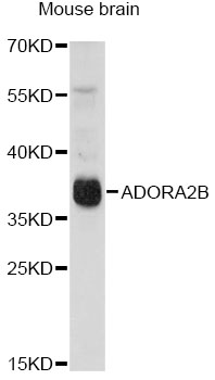 Western blot - ADORA2B Polyclonal Antibody 