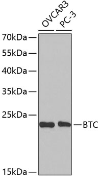 Western blot - BTC Polyclonal Antibody 