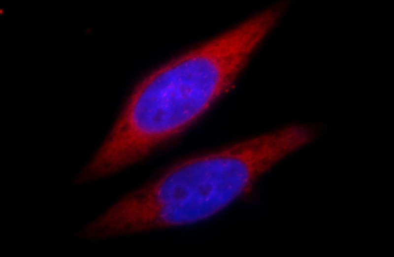 Immunofluorescent analysis of Hela cells, using FASN antibody Catalog No:110529 at 1:25 dilution and Rhodamine-labeled goat anti-rabbit IgG (red). Blue pseudocolor = DAPI (fluorescent DNA dye).