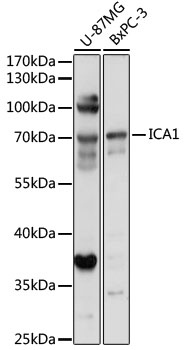 Western blot - ICA1 Polyclonal Antibody 