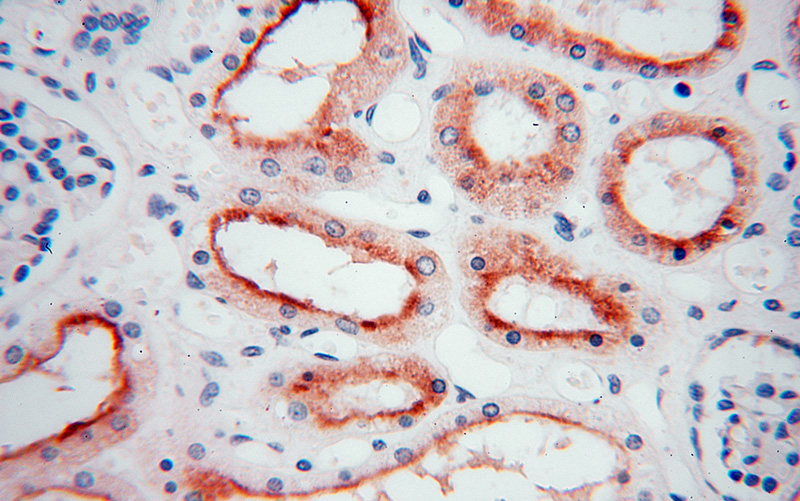Immunohistochemical of paraffin-embedded human kidney using Catalog No:113176(NHE8 antibody) at dilution of 1:100 (under 40x lens)