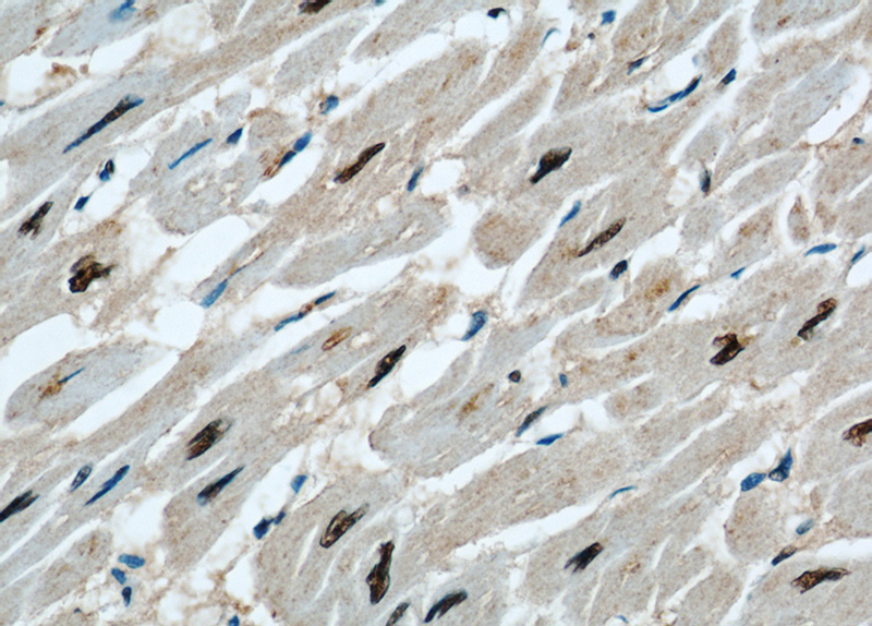 Immunohistochemical of paraffin-embedded human heart using Catalog No:115712(STK17A antibody) at dilution of 1:50 (under 40x lens)