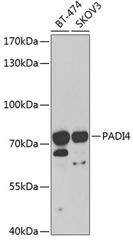 Western blot - PADI4 Polyclonal Antibody 