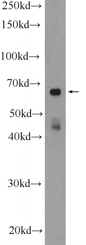 SKOV-3 cells were subjected to SDS PAGE followed by western blot with Catalog No:112280(LMF1 Antibody) at dilution of 1:600