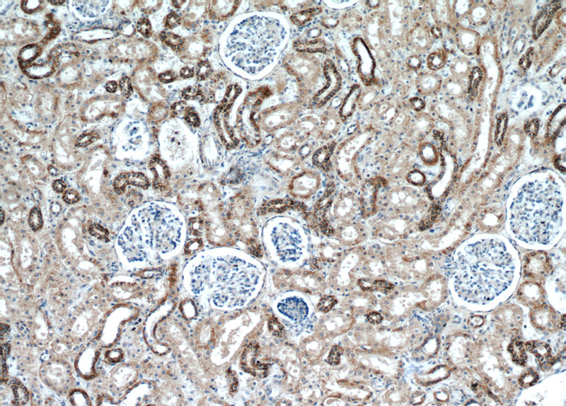 Immunohistochemical of paraffin-embedded human kidney using Catalog No:112035(GLS antibody) at dilution of 1:100 (under 10x lens)