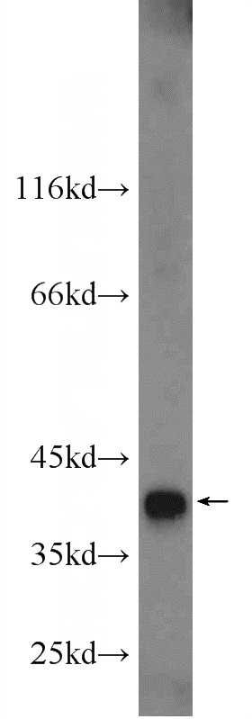 HeLa cells were subjected to SDS PAGE followed by western blot with Catalog No:116134(TIMM50 antibody) at dilution of 1:1000