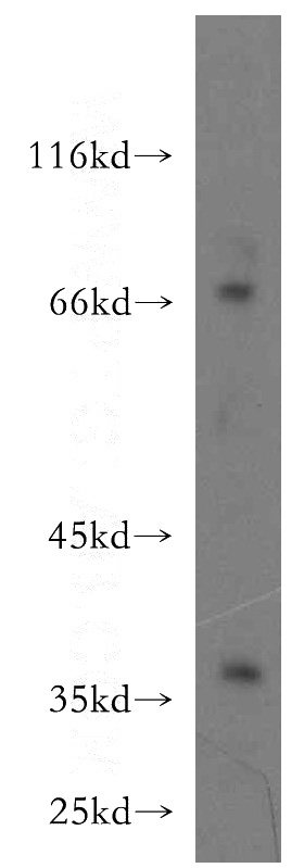 Jurkat cells were subjected to SDS PAGE followed by western blot with Catalog No:111657(IL10RB antibody) at dilution of 1:500