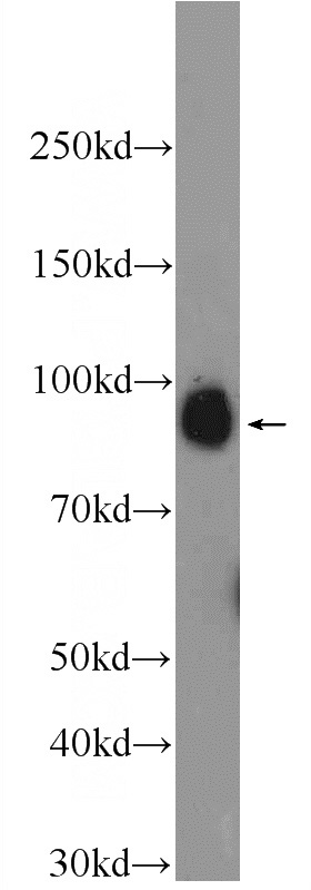 Jurkat cells were subjected to SDS PAGE followed by western blot with Catalog No:117269(ZW10 Antibody) at dilution of 1:1000