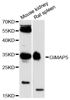 Western blot - GIMAP5 Polyclonal Antibody 