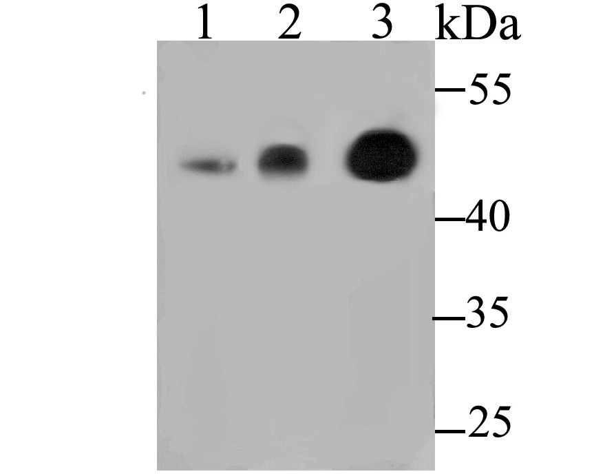 Fig1: Western blot analysis of CBARA1 on different lysates. Proteins were transferred to a PVDF membrane and blocked with 5% BSA in PBS for 1 hour at room temperature. The primary antibody was used at a 1:500 dilution in 5% BSA at room temperature for 2 hours. Goat Anti-Rabbit IgG - HRP Secondary Antibody (HA1001) at 1:5,000 dilution was used for 1 hour at room temperature.; Positive control:; Lane 1: Mouse kidney tissue lysate; Lane 2: Rat brain tissue lysate; Lane 3: Hela cell lysate