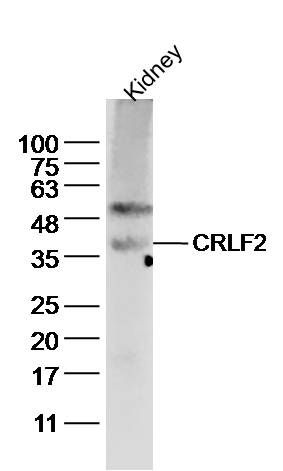 Fig1: Sample:kidney(mouse) Lysate at 40 ug; Primary: Anti-CRLF2 at 1/300 dilution; Secondary: IRDye800CW Goat Anti-Rabbit IgG at 1/20000 dilution; Predicted band size: 36kD; Observed band size: 36 kD