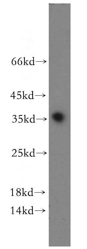 human testis tissue were subjected to SDS PAGE followed by western blot with Catalog No:114089(PPP1R2P9 antibody) at dilution of 1:300