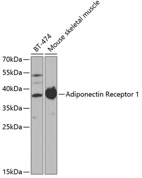 Western blot - Adiponectin Receptor 1 Polyclonal Antibody 