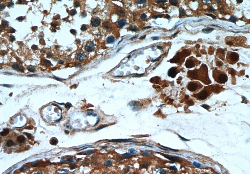 Immunohistochemical of paraffin-embedded human testis using Catalog No:114335(PTTG1IP antibody) at dilution of 1:50 (under 40x lens)
