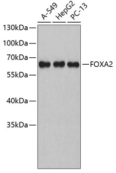 Western blot - FOXA2 Polyclonal Antibody 