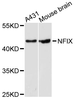 Western blot - NFIX Polyclonal Antibody 